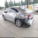 1G1ZD5ST5JF221598 2018 Chevrolet Malibu Lt auction photo thumbnail 3
