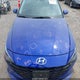 KMHLS4AG3PU526406 2023 Hyundai Elantra Sel auction photo thumbnail 19
