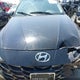 KMHLP4AG1PU525126 2023 Hyundai Elantra Limited auction photo thumbnail 13