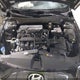 KMHLM4DGXSU991148 2025 Hyundai Elantra Sel Sport auction photo thumbnail 10