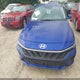 KMHLL4DG8RU849636 2024 Hyundai Elantra Se auction photo thumbnail 12