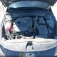 KMHLW4AKXNU007598 2022 Hyundai Elantra N auction photo thumbnail 10