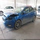 1FADP3H22JL282037 2018 Ford Focus Sel auction photo thumbnail 2