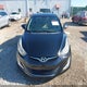 5NPDH4AE9FH599245 2015 Hyundai Elantra Se auction photo thumbnail 12