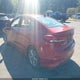 KMHD84LF3HU245327 2017 Hyundai Elantra Se auction photo thumbnail 3