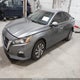 1N4BL4BW2LC132405 2020 Nissan Altima S Intelligent Awd auction photo thumbnail 2