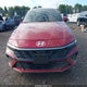 KMHLM4DG3RU703786 2024 Hyundai Elantra Sel auction photo thumbnail 12