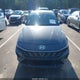 KMHLM4DG6SU955554 2025 Hyundai Elantra Sel Sport auction photo thumbnail 13