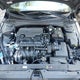 KMHLM4DG9SU973191 2025 Hyundai Elantra Sel Sport auction photo thumbnail 10