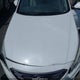 5NPE34AF9HH594657 2017 Hyundai Sonata Limited auction photo thumbnail 10