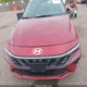 KMHLP4DG5RU778755 2024 Hyundai Elantra Limited auction photo thumbnail 6