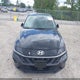 KMHLS4DG5RU789477 2024 Hyundai Elantra Sel auction photo thumbnail 12