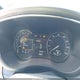 5LMTJ2DH9HUL41108 2017 Lincoln Mkc Select auction photo thumbnail 7