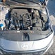 KMHLS4DG3RU759989 2024 Hyundai Elantra Sel auction photo thumbnail 10