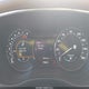 5LMCJ3B92FUJ14812 2015 Lincoln Mkc Black Label auction photo thumbnail 7