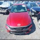KMHLL4DGXRU662463 2024 Hyundai Elantra Se auction photo thumbnail 12