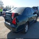 JHMES15221S000604 2001 Honda Civic Dx auction photo thumbnail 4