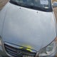 KMHDU4AD3AU177999 2010 Hyundai Elantra Gls auction photo thumbnail 17