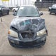 KMHDN56D96U202004 2006 Hyundai Elantra Gls/Gt/Limited auction photo thumbnail 12