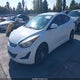 5NPDH4AE0FH548314 2015 Hyundai Elantra Se auction photo thumbnail 2