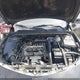 1G1ZD5ST2JF148173 2018 Chevrolet Malibu Lt auction photo thumbnail 10