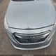 5NPE24AF8FH183007 2015 Hyundai Sonata Se auction photo thumbnail 10