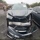 5J8YD4H57HL000961 2017 Acura Mdx Technology Package auction photo thumbnail 13