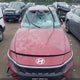 KMHLS4DG9SU882802 2025 Hyundai Elantra Sel Convenience auction photo thumbnail 12
