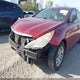 5NPEB4AC4BH059252 2011 Hyundai Sonata Gls auction photo thumbnail 6