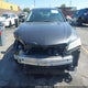 19UUB1F55FA016140 2015 Acura Tlx Tech auction photo thumbnail 13