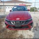 KMHLS4DG8RU751564 2024 Hyundai Elantra Sel auction photo thumbnail 11