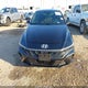 KMHLM4DG3SU992724 2025 Hyundai Elantra Sel Sport auction photo thumbnail 12
