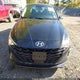 5NPLS4AG5MH030355 2021 Hyundai Elantra Sel auction photo thumbnail 12