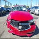 19UUB2F59JA012123 2018 Acura Tlx Tech Pkg auction photo thumbnail 6