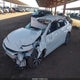 1G1ZG5ST4NF199607 2022 Chevrolet Malibu Fwd Rs auction photo thumbnail 2