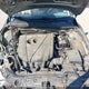 3MZBM1U77FM202721 2015 Mazda Mazda3 I Sport auction photo thumbnail 10