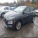 KM8K6CAA4JU111298 2018 Hyundai Kona Sel auction photo thumbnail 2