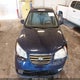 KMHDU46D28U293102 2008 Hyundai Elantra Gls/Se auction photo thumbnail 6