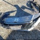 KMHLL4DG7RU826591 2024 Hyundai Elantra Se auction photo thumbnail 19