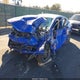 19UUB3F68JA002780 2018 Acura Tlx Tech A-Spec Pkgs auction photo thumbnail 2