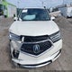 5FRYD4H58HB033726 2017 Acura Mdx Technology Package auction photo thumbnail 11