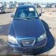 KMHDN46DX4U828233 2004 Hyundai Elantra Gls/Gt auction photo thumbnail 12