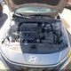 KMHLM4DG8SU976034 2025 Hyundai Elantra Sel Sport auction photo thumbnail 10