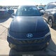 KMHLS4DGXSU935782 2025 Hyundai Elantra Sel Convenience auction photo thumbnail 12