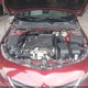 1G1ZB5ST6GF191154 2016 Chevrolet Malibu Ls auction photo thumbnail 10
