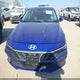 KMHLM4DGXRU786777 2024 Hyundai Elantra Sel auction photo thumbnail 12