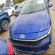 KMHLL4DG1RU657460 2024 Hyundai Elantra Se auction photo thumbnail 12