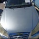 KMHDU4AD8AU103333 2010 Hyundai Elantra Gls auction photo thumbnail 10