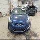 5NPDH4AE7FH592617 2015 Hyundai Elantra Se auction photo thumbnail 12