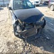 3VWDZ7AJ4BM328669 2011 Volkswagen Jetta 2.5L Se auction photo thumbnail 6